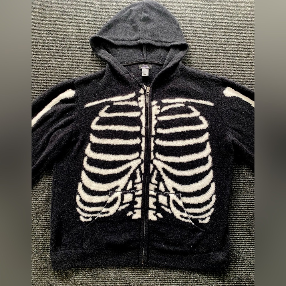 Social Collision Black and White Zip Skeleton Hoodie- Size 1 - Picture 2 of 8